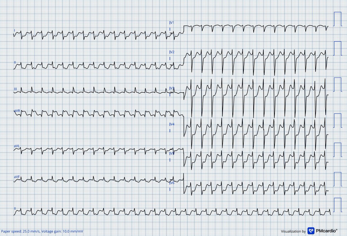 Cesar Salinas tweet media