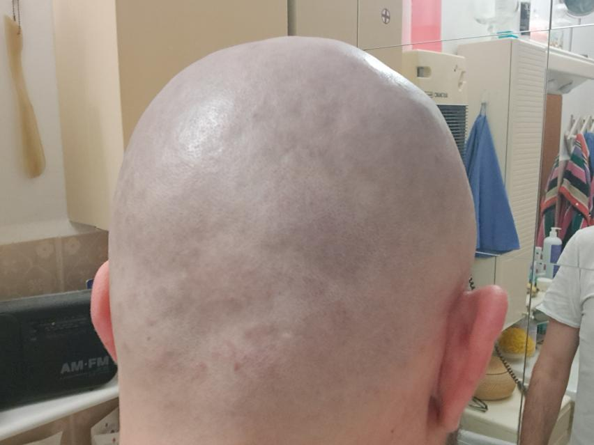 andy_mistezena's tweet photo. pelato alla porco dio #bald #pelato #headshave https://t.co/74ZqlOl31t
