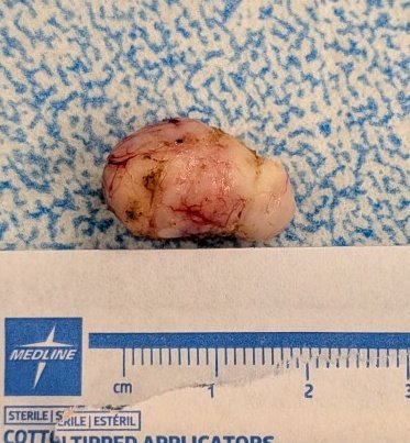 Prashant Kedia MD, FACG, FASGE tweet media