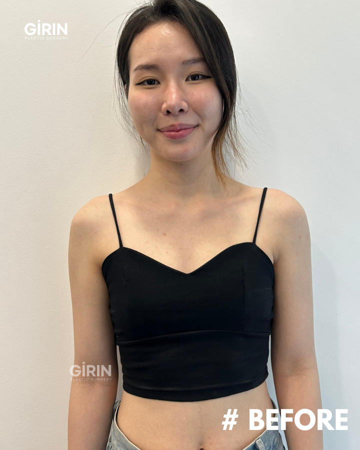 韓国・江南で豊胸手術が得意な美容外科は？ 👉 キリン美容外科 豊胸