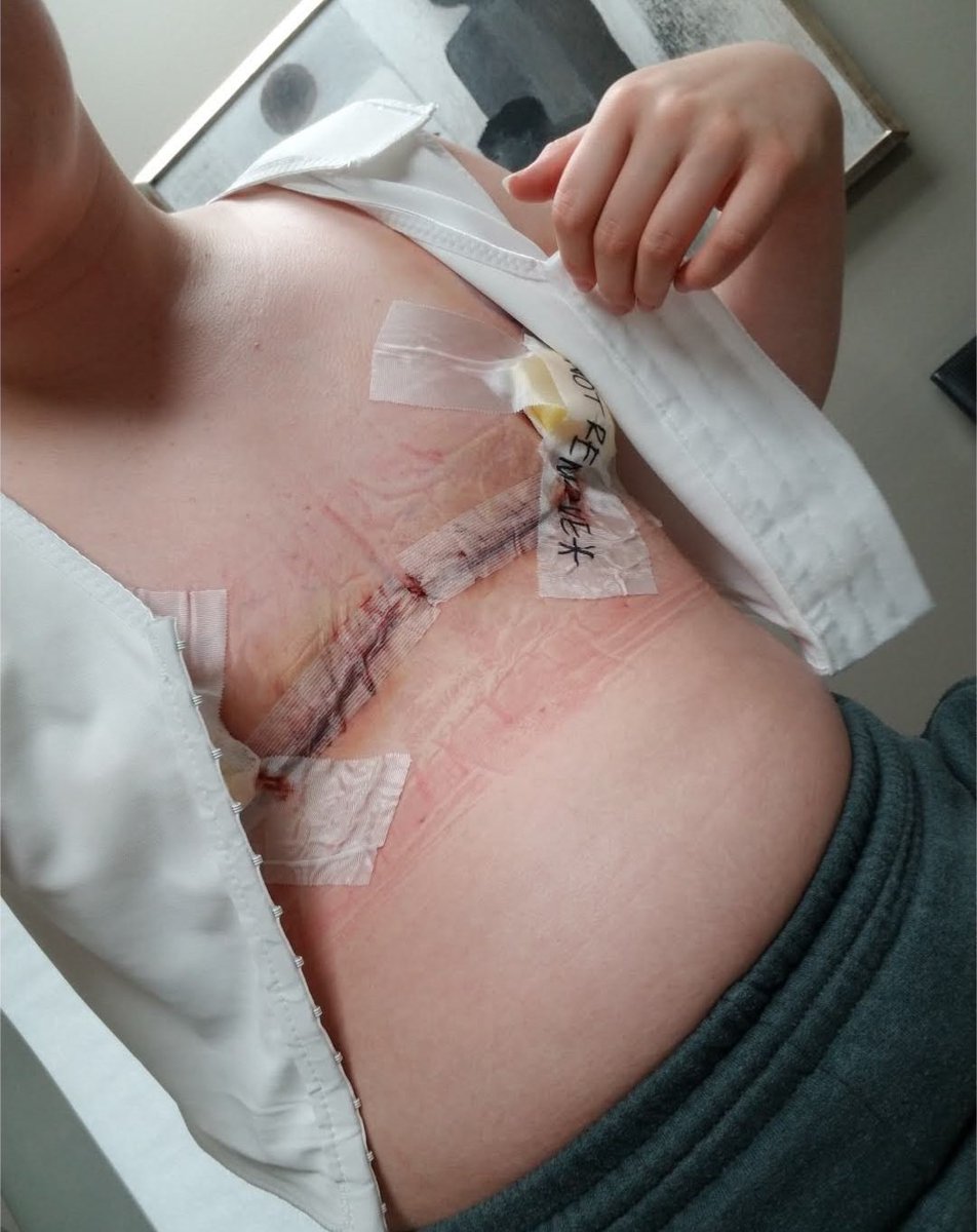 burnyourbinder's tweet image. this is me at 14. this is what Phil Weiser and the state of Colorado are fighting to do to your children.