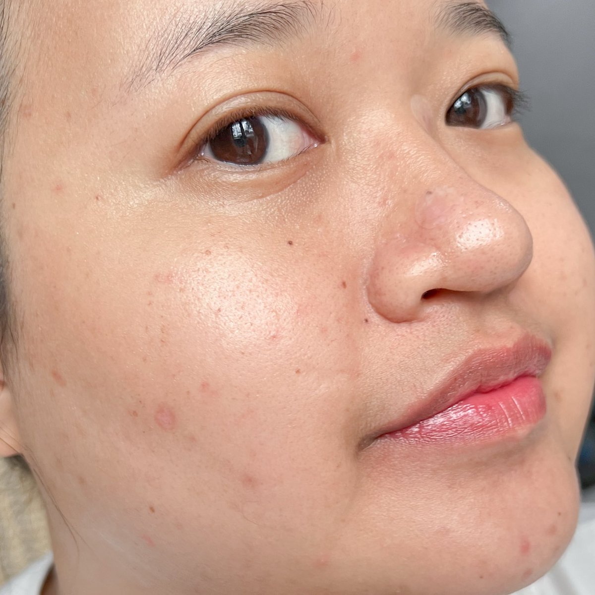 callmejingz's tweet image. กลับมาตุนต่อกับ MizuMi เซรั่มไฮยา สูตรสีฟ้า มีไฮยาบริสุทธิ์เข้มข้น 3% ทั้งล็อคและเติมความชุ่มชื้นให้ผิวนาน คือชอบจริง เนื้อเซรั่มชีไม่เหนียวเลย ซึมไวมากก แถมปลอบประโลมผิวดี ใช้แล้วผิวดูอิ่ม ฉ่ำน้ำ อ่อนโยนต่อผิวแพ้ง่ายด้วยนะ ผิวแข็งแรงขึ้นเลยย

 #ใช้จริงรีวิวจริง #MizuMi…