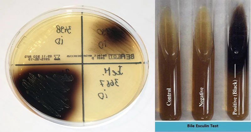 LabTips_10's tweet image. 🧪 Esculin Hydrolysis Test | اختبار تحلل الإسكولين

اختبار بسيط يستخدم في الميكروبيولوجي لتمييز بعض البكتيريا، خصوصًا Enterococcusو Group D Streptococci.

فكرة الاختبار :
بعض البكتيريا تملك إنزيم β-glucosidase
هذا الإنزيم يقدر يكسر مادة اسمها Esculin 

حلو..لما يكسرها وش يصير؟
⬇️