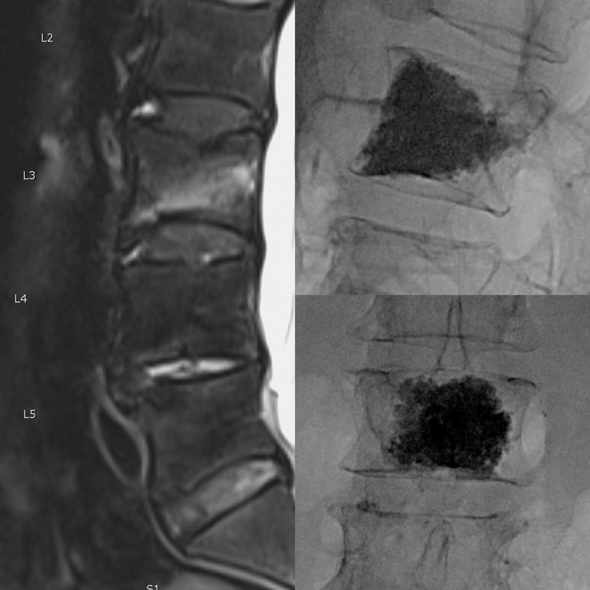 Jacob Fleming, MD tweet media