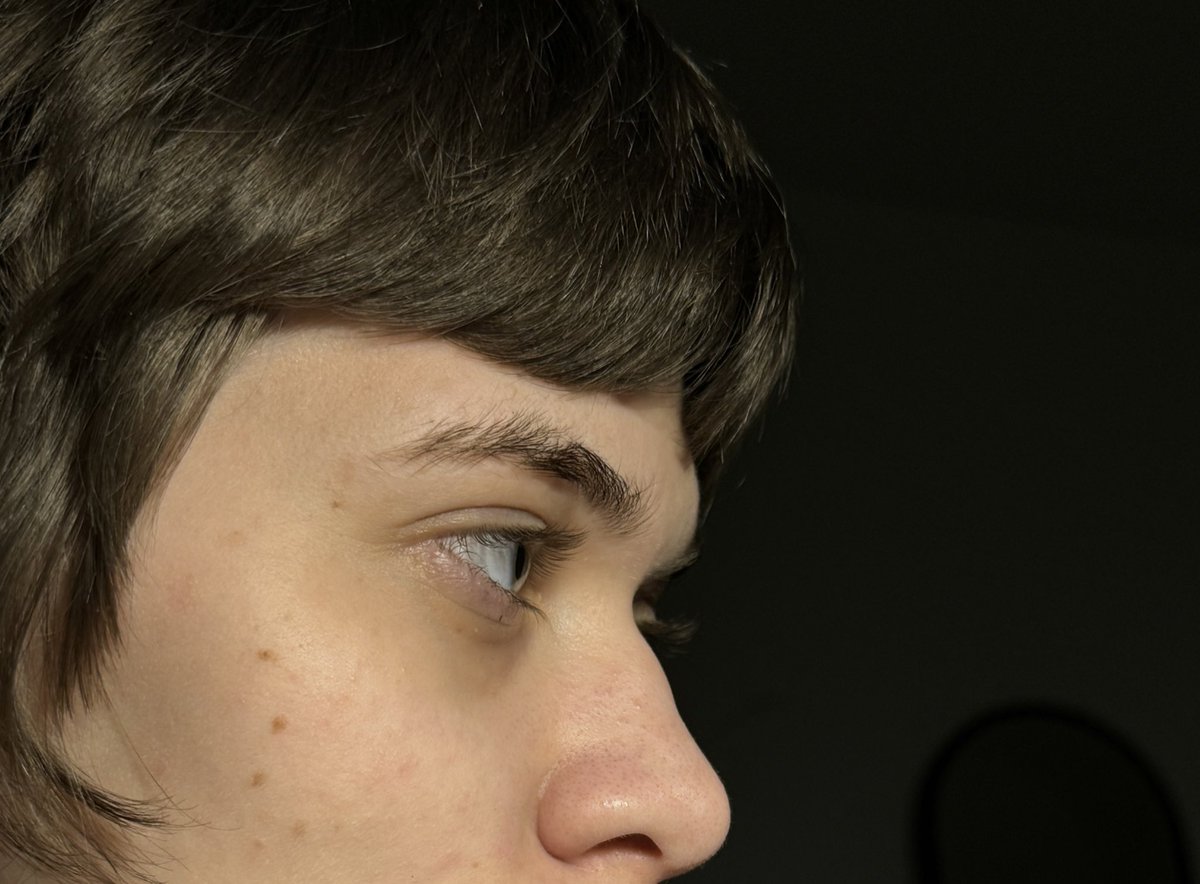 сука коли я говорила що мені подобаються носи з горбинкою я не мала на увазі шо горбика отримана в результаті удару коліном