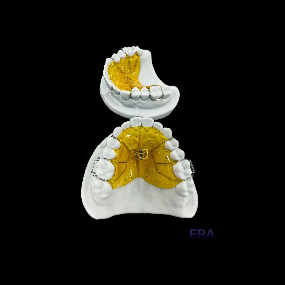 EraDentalLab's tweet image. Spring Expander #DentalLab #DentalLabTech #DentalProsthetics #DentalRestoration #DentalCrown #DentalImplants #Dentistry 

©ERA Dental Lab. All Rights Reserved.
Unauthorized use or reproduction of our work is strictly prohibited. Do not copy or repost without permission.