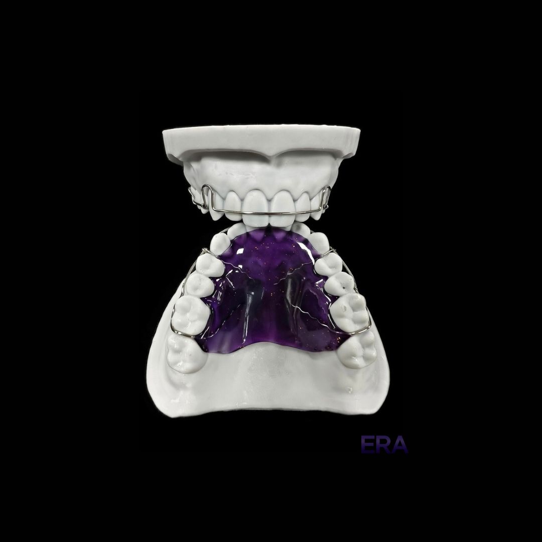 EraDentalLab's tweet image. Begg Retainer #DentalLab #DentalLabTech #DentalProsthetics #DentalRestoration #DentalCrown #DentalImplants #Dentistry 

©ERA Dental Lab. All Rights Reserved.
Unauthorized use or reproduction of our work is strictly prohibited. Do not copy or repost without permission.