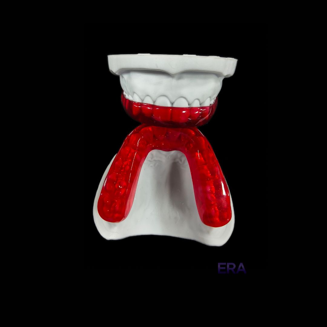 EraDentalLab's tweet image. Hard Night Guard #DentalLab #DentalLabTech #DentalProsthetics #DentalRestoration #DentalCrown #DentalImplants #Dentistry 

©ERA Dental Lab. All Rights Reserved.
Unauthorized use or reproduction of our work is strictly prohibited. Do not copy or repost without permission.