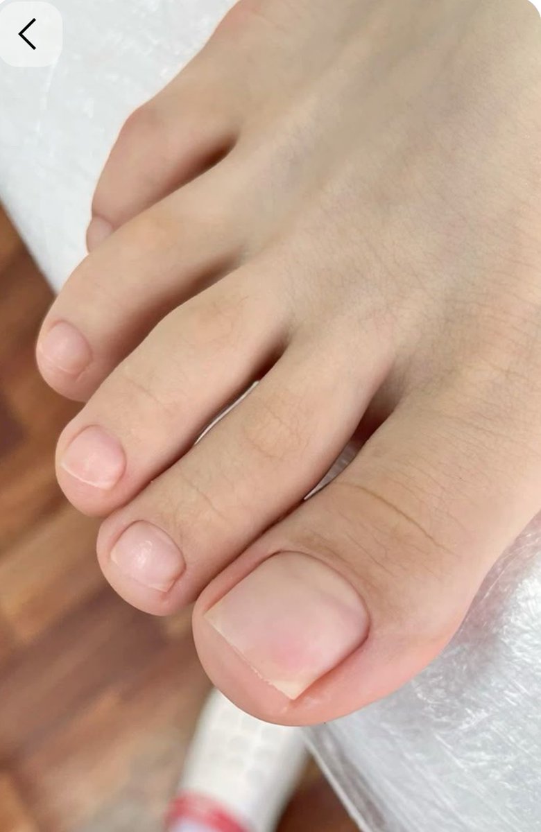 ceresario1's tweet image. Natural #toenails