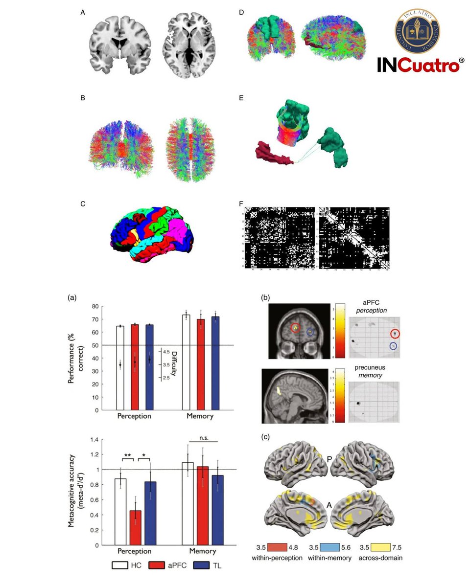RebolledaGil's tweet photo. Tu personalidad puede cambiar: la neuroplasticidad desmiente el mito del ‘así soy'.
Durante décadas se creyó que la personalidad era fija. Hoy sabemos que la neuroplasticidad permite modificar patrones de pensamiento, conducta y emoción incluso en la adultez. 👇 https://t.co/zCtq9Q8PbZ