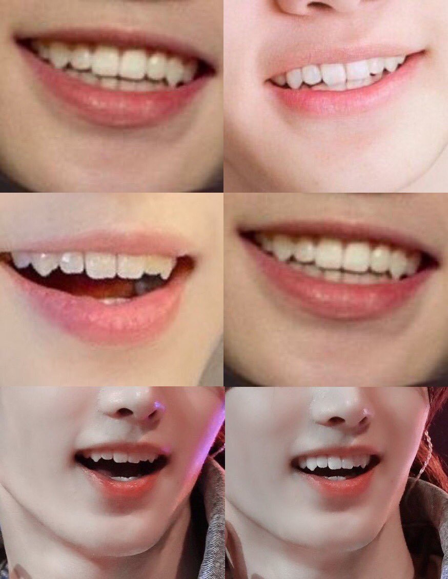 hoons's tweet photo. Living forever is whatever, but have you seen the price of fang treatments lately? One tiny adjustment and suddenly I’m paying like I asked for a full makeover. Immortality didn’t prepare me for the fact that my biggest expense would be dental.

 #vampirenowtwt https://t.co/1F1I9FPjQk