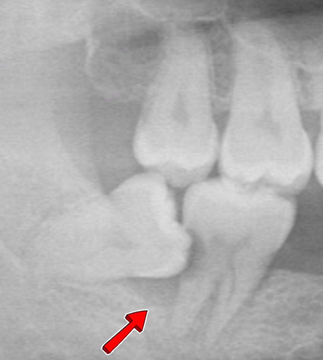 Dr. Patrick Anghel 🦷 tweet media