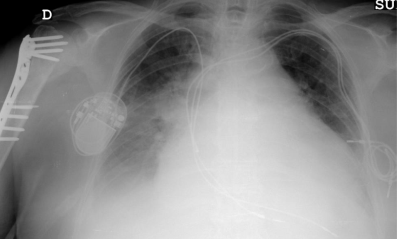 Esta tarde se impartirá uno de los módulos de la siguiente asignatura del Máster. La jornada se centrará en el estudio de las infecciones asociadas a dispositivos médicos, a cargo de especialistas que abordarán el diagnóstico, los tratamientos y nuevas estrategias.