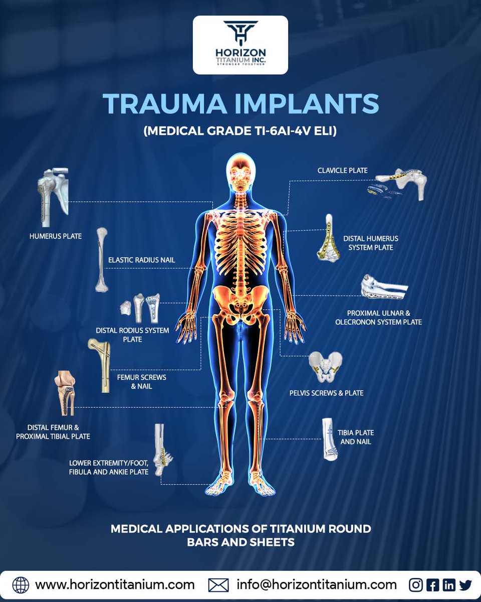 HorizonTitanium's tweet photo. Trauma implants stabilize fractured bones for proper healing.
Titanium Ti-6Al-4V ELI is preferred for its biocompatibility, strength, and corrosion resistance.

Learn more: info@horizontitanium.com https://t.co/QVs6dj83fN