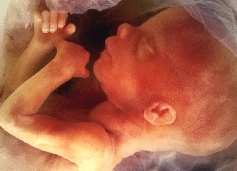 <a href="/jackfchambers/">Jack Chambers TD</a> who once claimed to be “pro-life” voted last night for a radical left PBP Bill to legalise abortion up to birth and remove the three day waiting period. 
No doubt most of Chambers voters would not support abortion up to birth. Chambers has been corrupted.