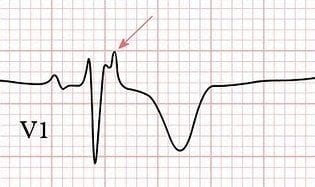 CardiovascularCorner tweet media