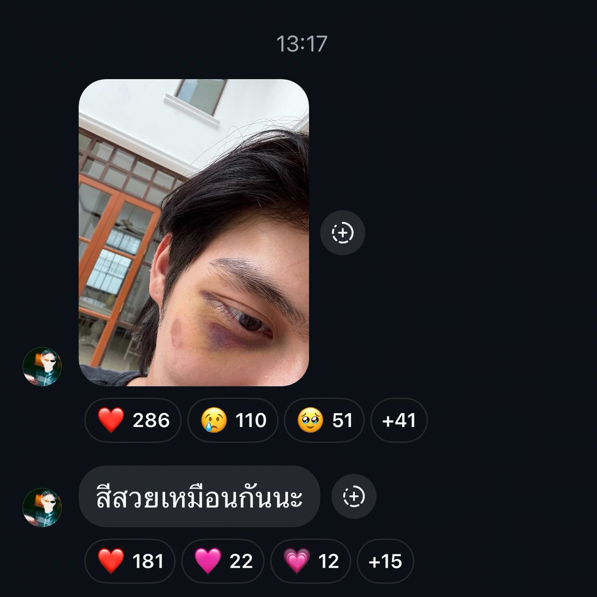 tamako_bbr's tweet photo. "เธชเธตเธชเธงเธขเนเธซเธกเธทเธญเธเธเธฑเธเธเธฐ"
๐ญ๐ญ๐ญ๐ญ๐ญ๐ญ๐ญ๐ญ๐ญ๐ญ๐ญ๐ญ๐ญ
bright broadcast
#bbrightvc @bbrightvc #brights https://t.co/KtlXXUJWAS