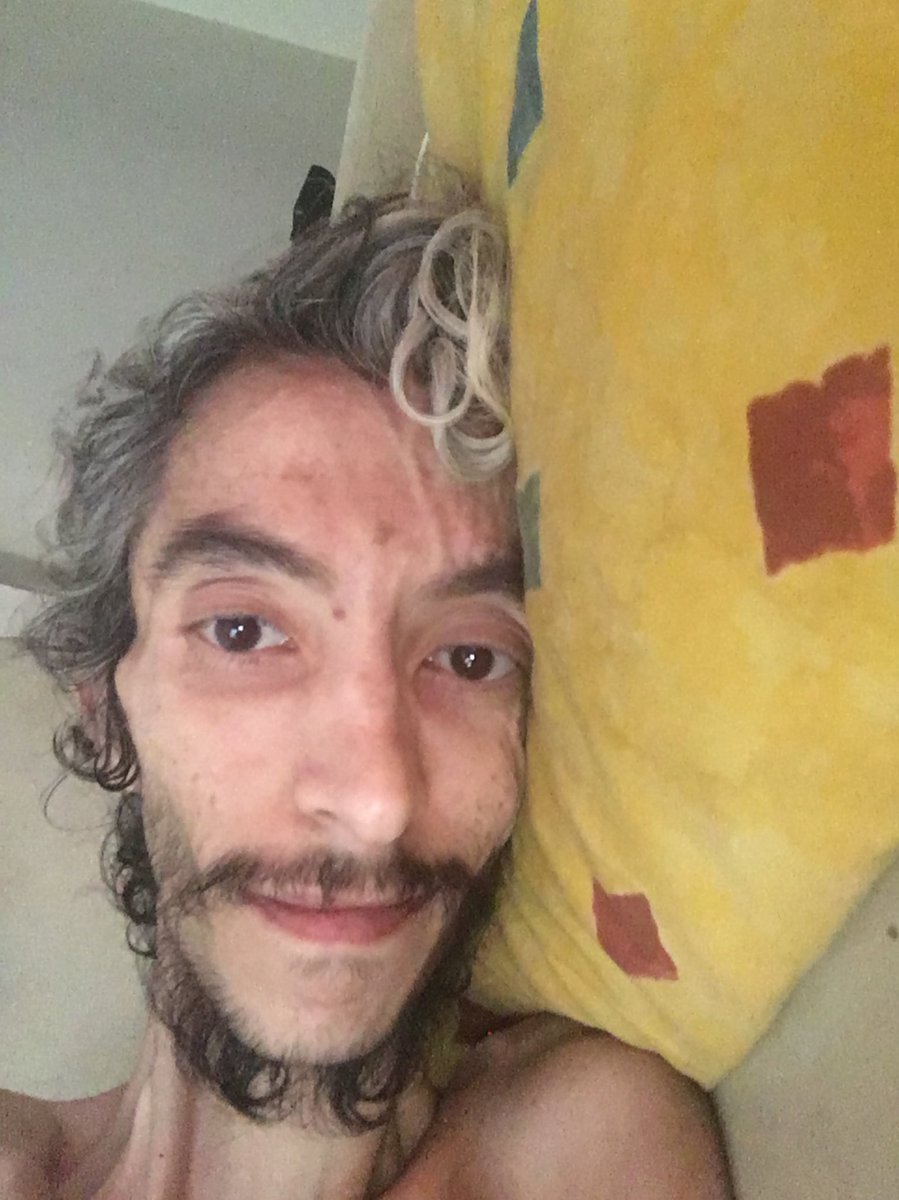 KnowsDont's tweet image. Herkese günaydın bu gün daha iyiyim lakin bir tek ricam var uygun görmeniz durumunda 27 aralıkta Ankara’ya gelmek istiyorum Atamın karşısında selam durmak istiyorum doktor iznimi aldım lakin yürüme zorluğum var biraz bununla alakalı benim yanımda destekçi yürüyüş sağlayabileceğim…