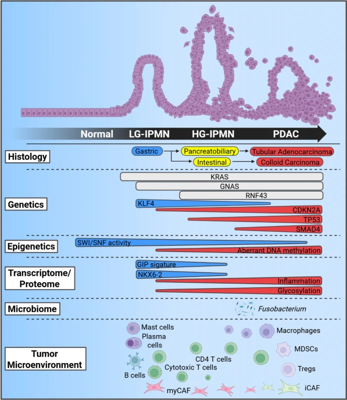 Aiims1742's tweet photo. Molecular pathology of intraductal papillary mucinous neoplasms of the pancreas (cystic precursor lesions to #PancreaticCancer) 
https://t.co/VfH6s9ZMp5
A review written by past and present members of the Maitra lab, including two (Makino &amp; Thege) that now have their own labs. https://t.co/687ZrqbMWP