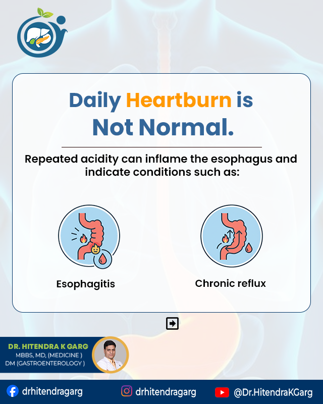 DrHitendraKGarg's tweet image. Heartburn that shows up once in a while may seem harmless.
But when it becomes a daily problem, your body is trying to tell you something.

📲 8920361841, 8920632657
Visit: drhitendrakgarg.com

#HeartburnAwareness #AcidityProblems #RefluxCare #GERD #DigestiveHealth