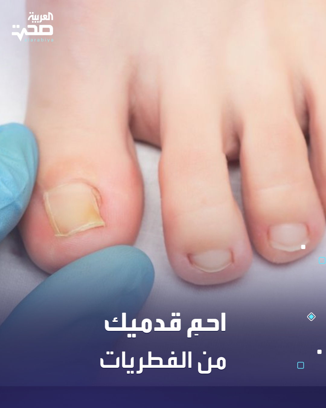 معلومة طبية من العربية صحة : تُعد فطريات القدم من الالتهابات الجلدية الشائعة. تزداد احتمالية الإصابة لدى الرياضيين ومستخدمي الحمامات والمسابح العامة وكبار السن والذكور. يرتبط خطر الإصابة بعوامل مثل فرط التعرق وارتداء أحذية مغلقة لفترات طويلة والعيش في بيئات رطبة بالإضافة إلى الأمراض المزمنة كالسُّكري. تحدث العدوى غالبًا بسبب التعرض للرطوبة المستمرة أو ارتداء أحذية غير جيدة التهوية أو المشي حافيًا في أماكن عامة رطبة مثل الحمامات والمسابح إلى جانب مشاركة المناشف أو الأحذية أو وجود جروح صغيرة تُسهّل دخول الفطريات. يمكن الوقاية من فطريات القدم عبر الحفاظ على جفاف القدمين يوميًا وارتداء أحذية وجوارب تسمح بالتهوية وتجنب المشي حافي القدمين في الأماكن العامة صحة _صحة 