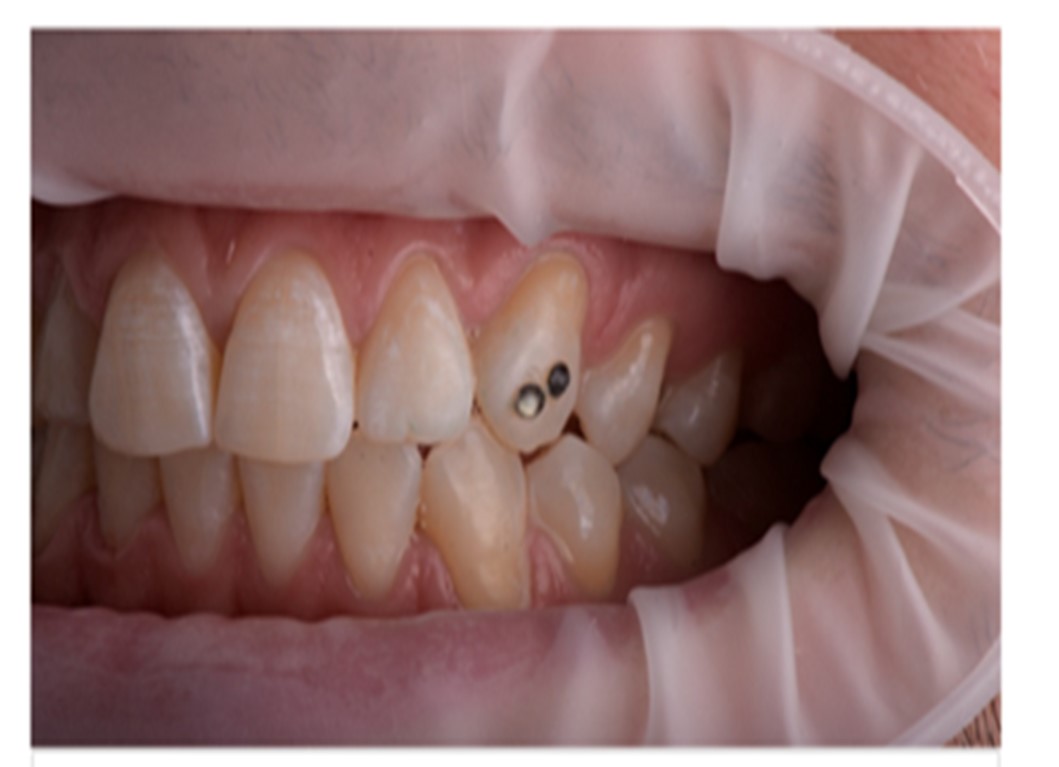 Journal of Dental Health & Oral Research tweet media