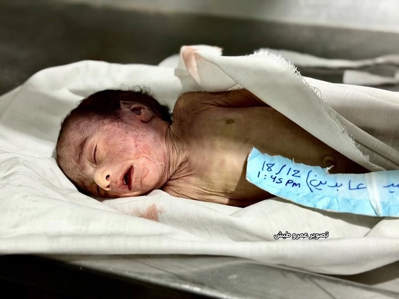 🚨 BREAKING: An infant, Saeed Asaid Abdeen, aged one month, died due to severe cold, bringing the death toll from the cold wave in the Gaza Strip to 13.