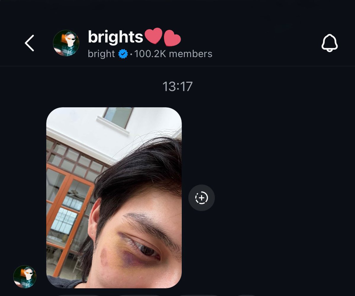 tamako_bbr's tweet photo. ๏ผผover 100K, 102K members!!!๏ผ
so so so so amazing๐คโจ
bright IG broadcast channel
#bbrightvc @bbrightvc #brights https://t.co/kz2uoW0033