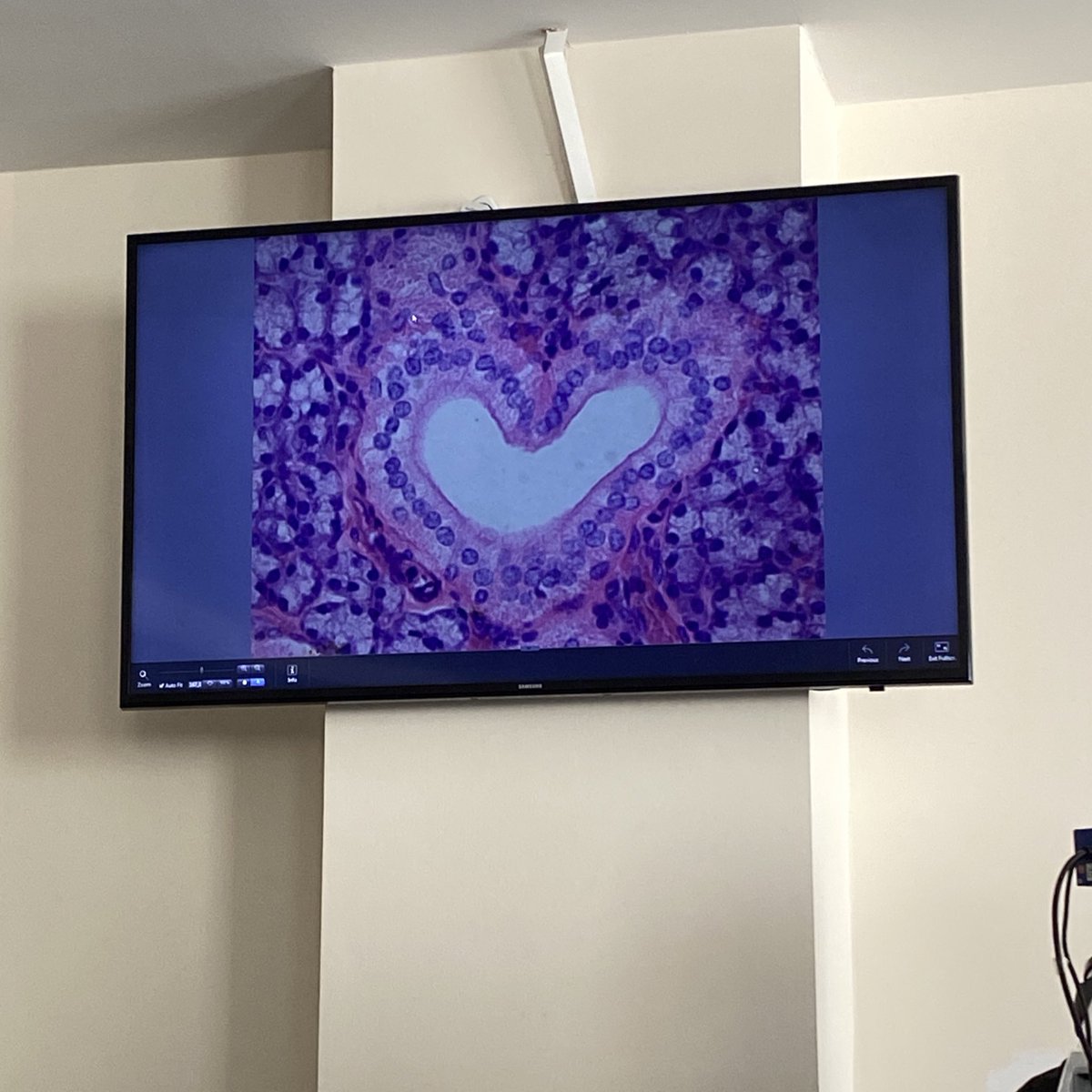 favlayan aski buluyo