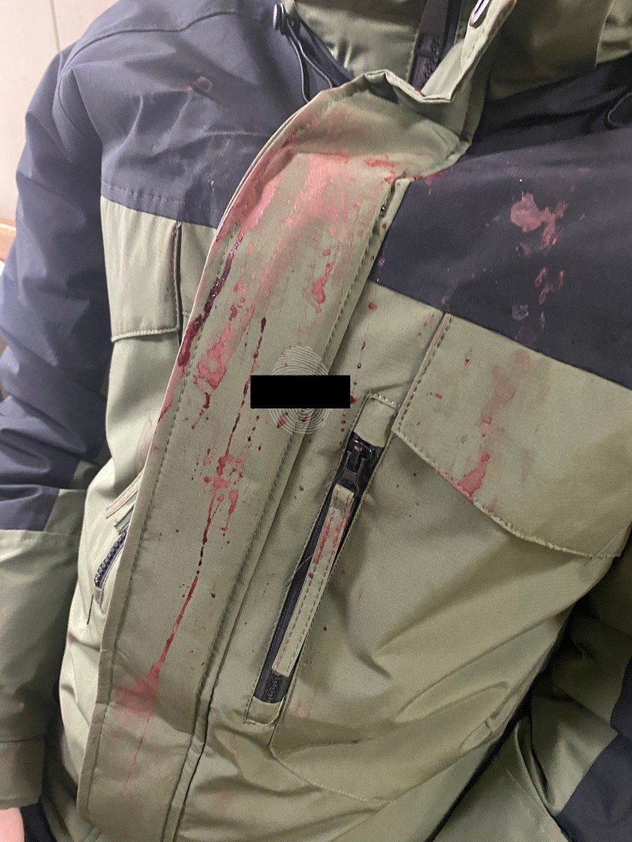 vladimirov58209's tweet image. Посла Азерботостана уже вызвали на ковёр?

«Стекла от очков разрезали лицо и чуть не лишили зрения»: - в Нижнем Тагиле абу бандит занимающийся кикбоксингом напал сзади в крысу и зверски избил восьмиклассника!