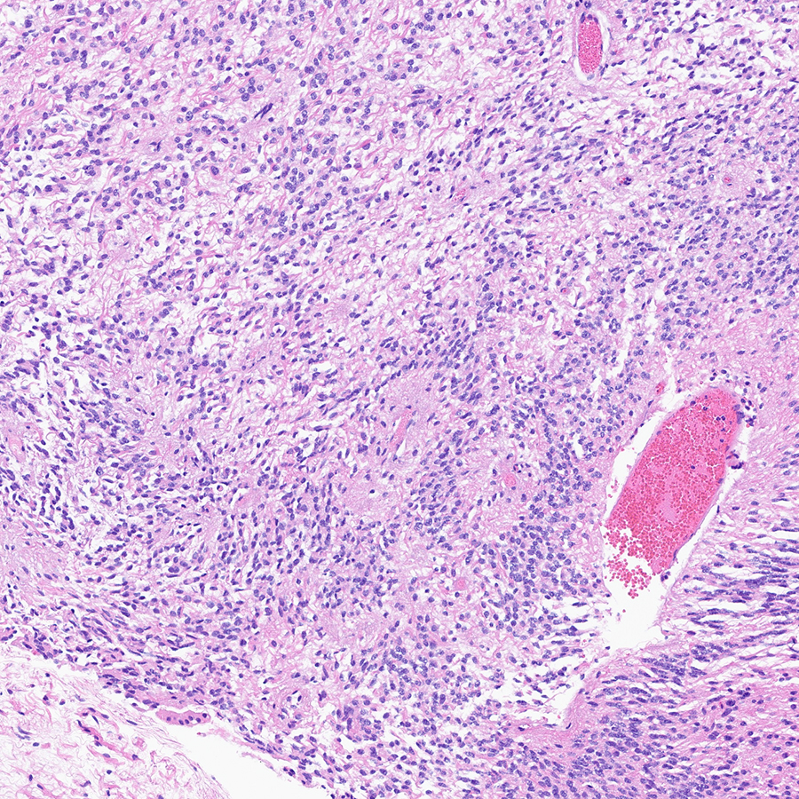 Craig Horbinski tweet media