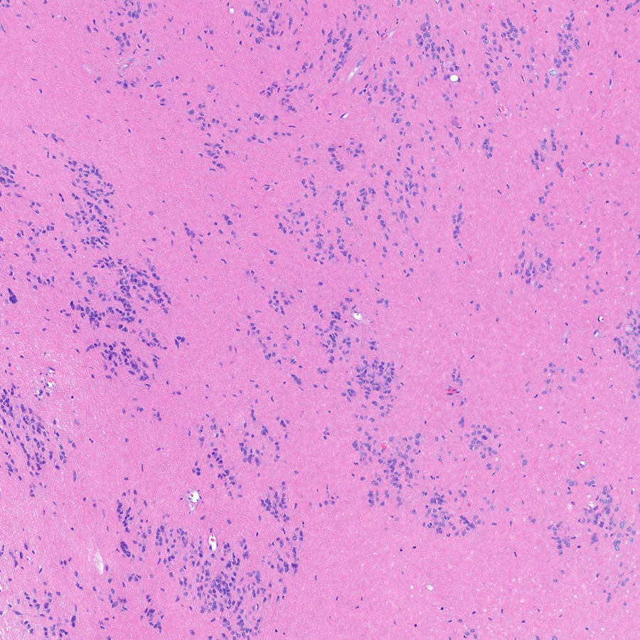 Craig Horbinski tweet media