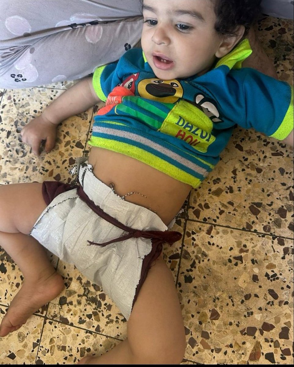 yousefQasem1998's tweet image. MY CHILD Will DIE😭

Unfortunately, my child, Mohammed, has been classified as malnourished, suffering from severe weakness and loss of appetite. I appeal to you to help provide milk  and vitamins

If you’re scrolling, PLEASE leave a dot . it's just a dot

chuffed.org/project/154635…