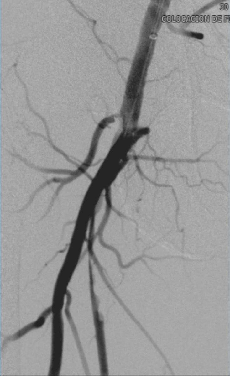 Necio Lizola MD tweet media