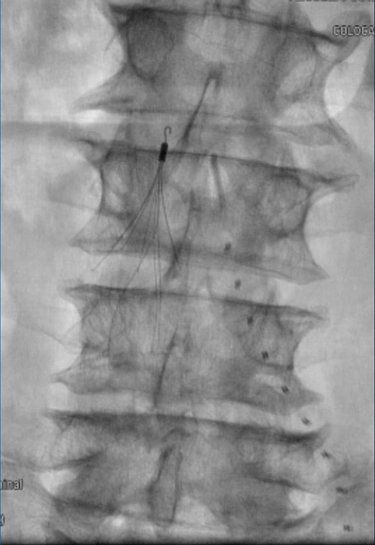 Necio Lizola MD tweet media