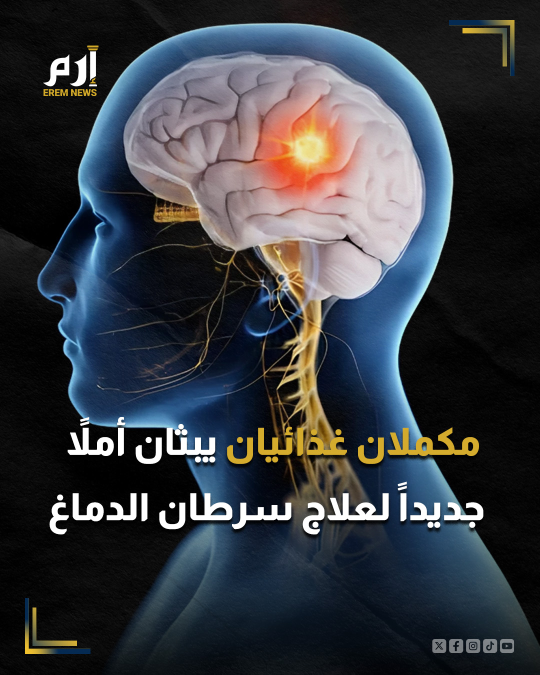 في خطوة واعدة ضد أحد أخطر أنواع السرطان الدماغي، أظهرت دراسة جديدة تأثيرًا مشجعًا لمكملين غذائيين شائعين في الورم الأرومي الدبقي؛ ما قد يمهّد لأسلوب جديد في العلاج بعيدًا عن الكيماوي والإشعاع التقليدي.. : 