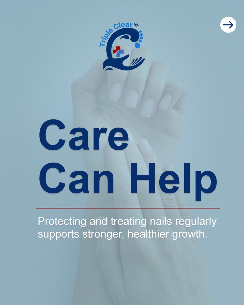 TripleClearHF's tweet image. Hormone shifts can leave nails dry, brittle, or slow-growing.

Triple Clear HF treats and protects nails, supporting strength, shine, and resilience through natural changes.

Strengthen your nails today: TripleClearHF.com

 #TripleClearHF #NailCare