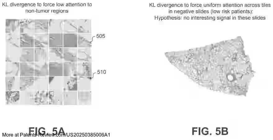 PatentPulse's tweet photo. ๐ New #PatentApplication alert! Hoffmann-La Roche's #US20250385006A1 explores #AttentionBased #MultipleInstanceLearning for predicting disease progression.
Using neural networks, it processes digital pathology images to generate attention scores & predict disease outcomes.
A step forward in #Healthcare innovation by $RHHBY.
#AI meets #DigitalPathology in this cutting-edge approach.
#Roche