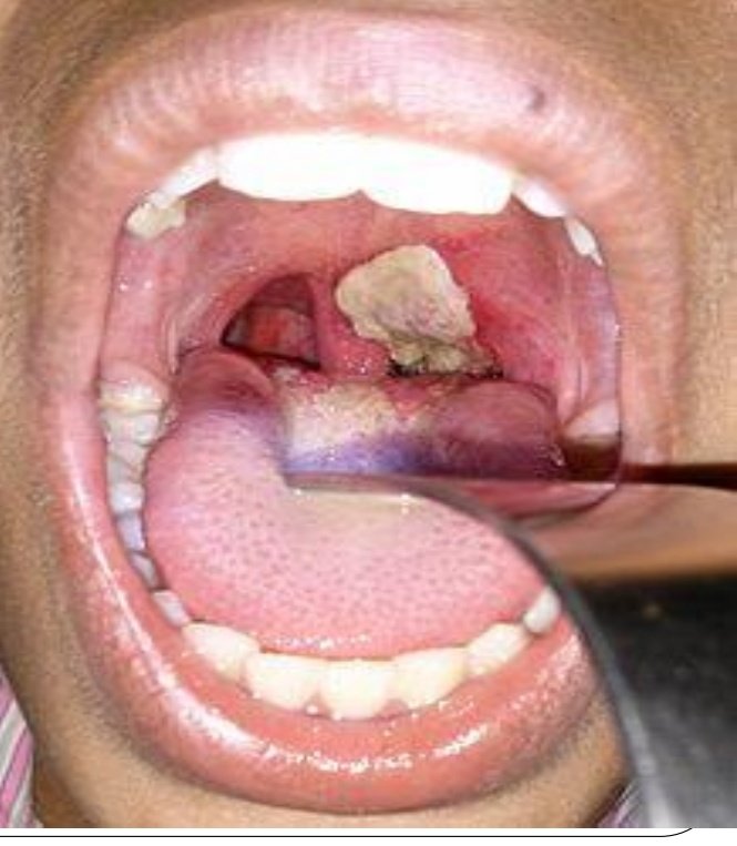 DR. Abdulrahman tweet media