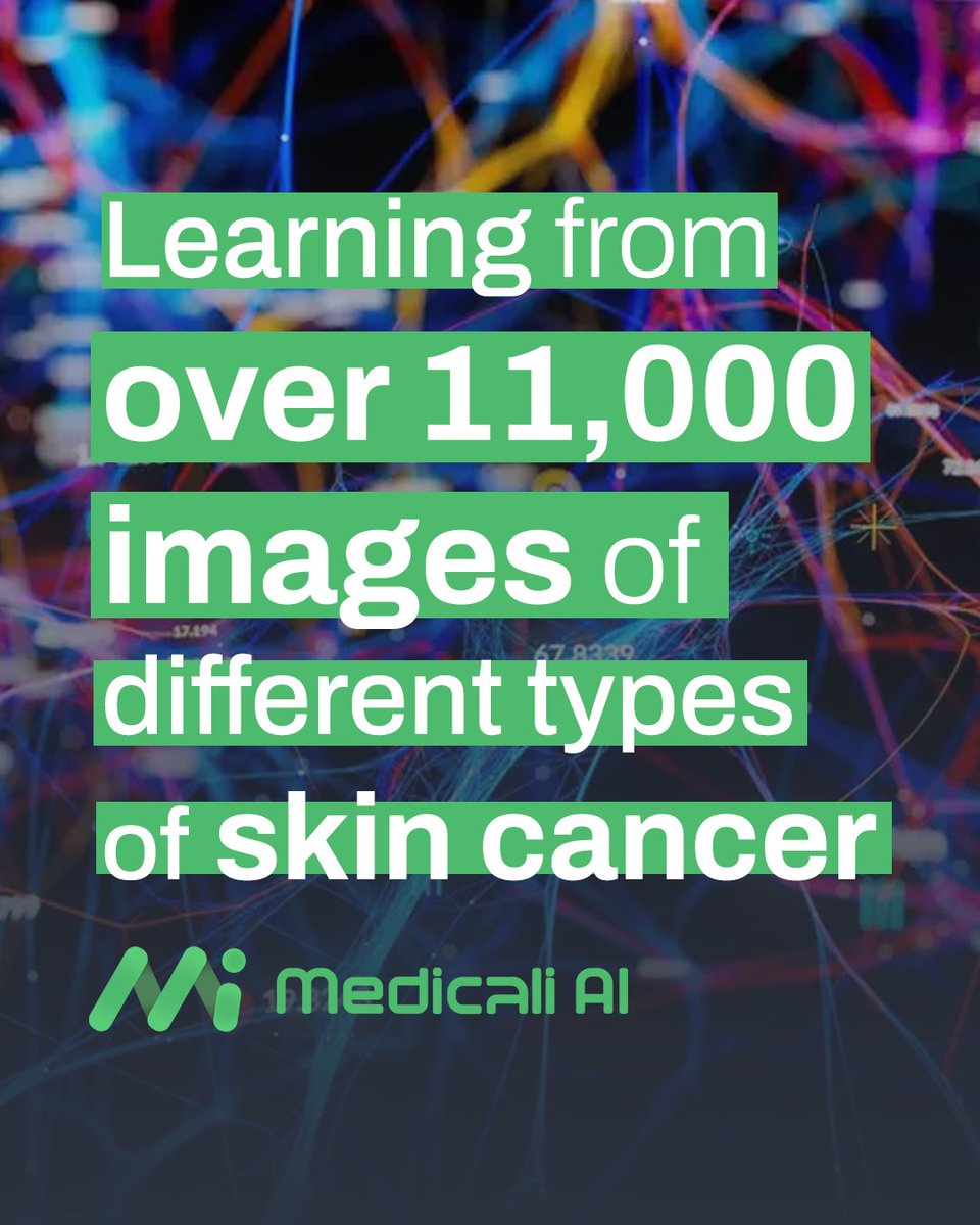 Medicaliaicom's tweet photo. 🧠🤖 Medicali AI is trained on 11,000+ real skin cancer images, enabling recognition of diverse patterns, colors, and skin structures for more reliable diagnosis. 🩺🔬

#MedicalAI #SkinCancerDetection #AIinHealthcare #DeepLearning #DermatologyAI https://t.co/NHWnBthVNs