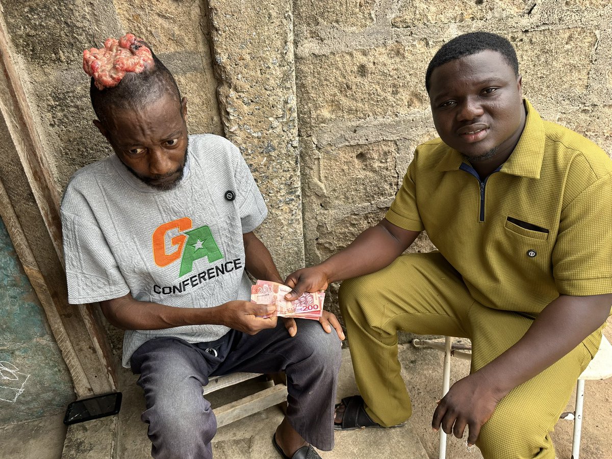 SAD😭💔‼️
Unfortunately we couldn’t raise his GHc100,000 Surgery Money. We raised GHc13,500 which will be given to him as he has started his Process. 
Abusua please this is my last post about him and let’s use this last post to Raise enough Funds for him. 
No Amount is too small