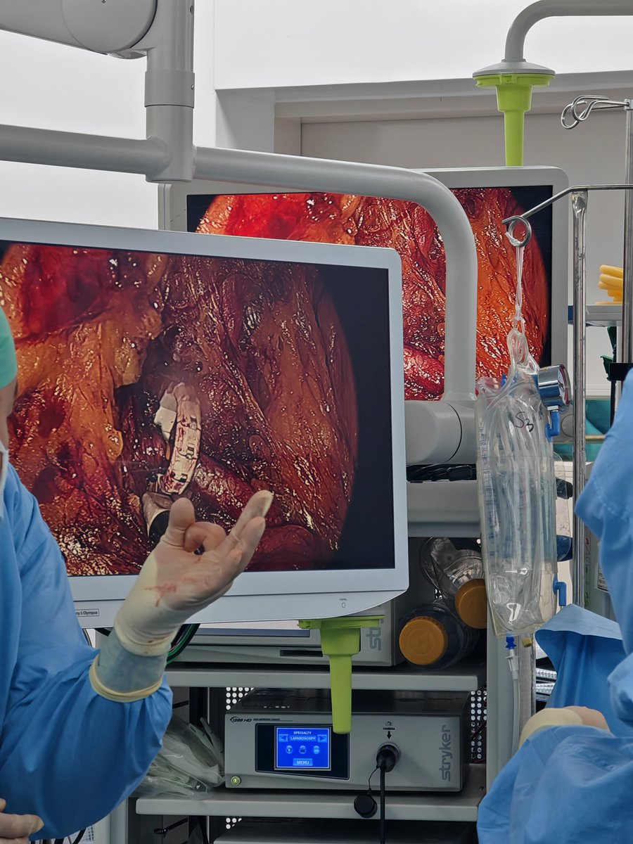 AbdallaDeb's tweet photo. “A front-row seat to medical magic ✨ Live renal artery denervation at @snuh_official—where resistant hypertension meets a powerful 30-minute keyhole procedure by @drboss_urology

#HyperQure™ #UroSoMe #MedTwitter #UroTech https://t.co/7KdYjWpkXi