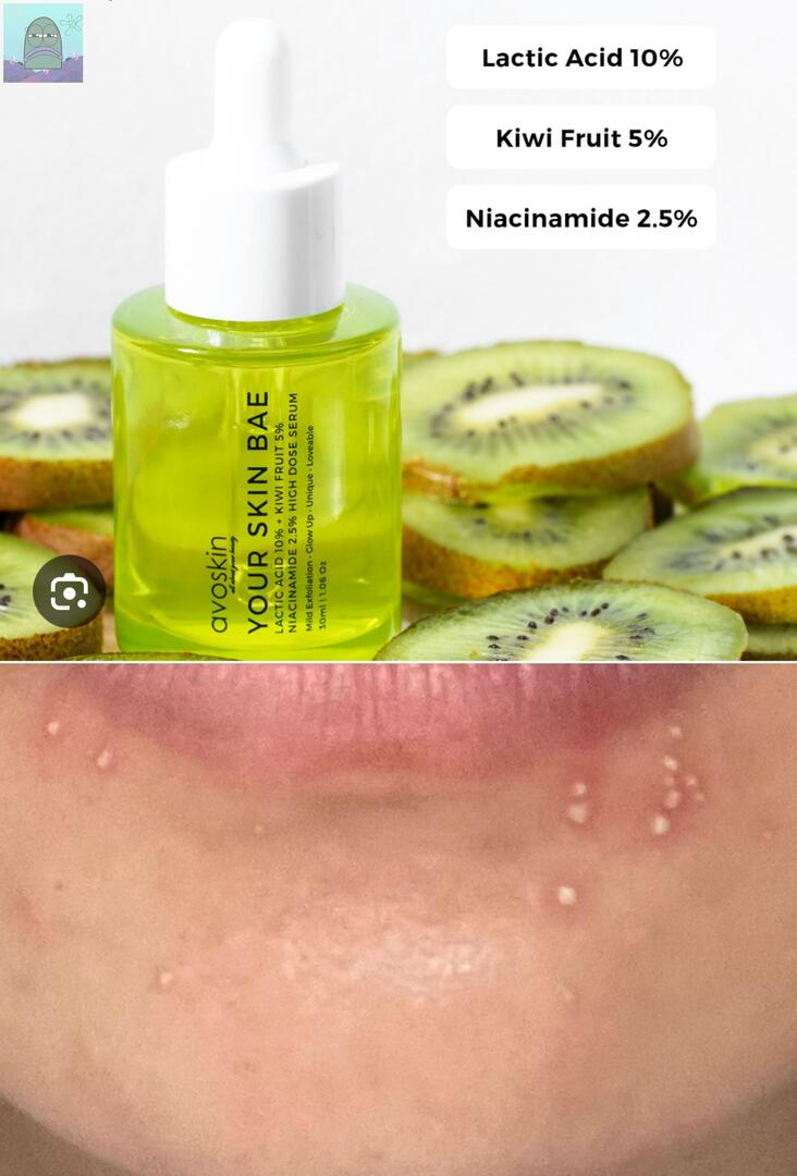 Tanyarl 💚 tweet media