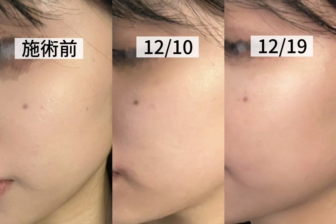 치이🥨韓国整形 tweet media