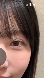 【公式】MIHO ミホ整形外科 tweet media