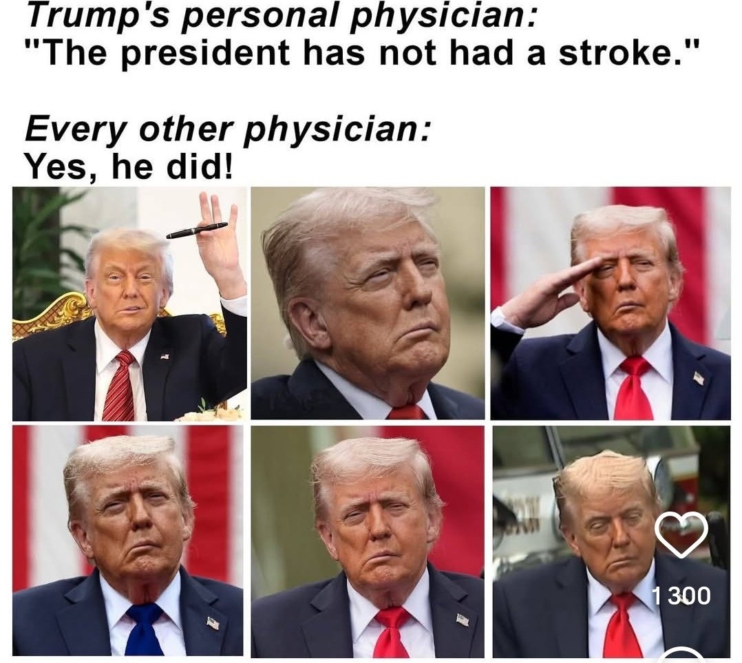 glenn_tunes's tweet image. HE HAD A STROKE 🤷