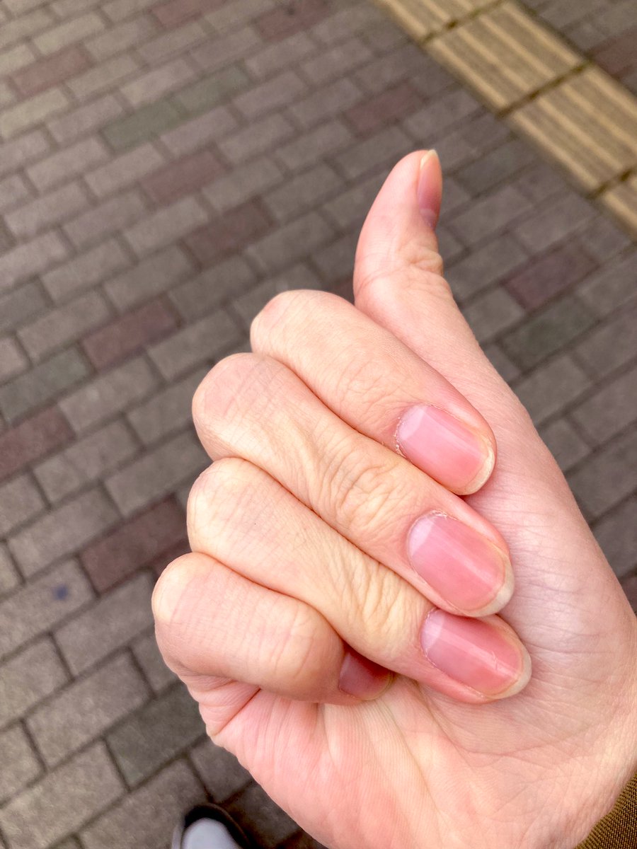 InsaneKOSE's tweet photo. ささくれうざすぎる https://t.co/jqoeH7eCFu