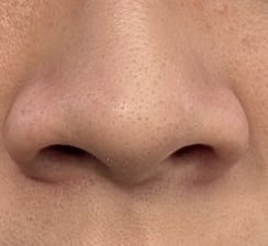 Genkiiill's tweet photo. before                                          after https://t.co/cqkcQ8wHwX