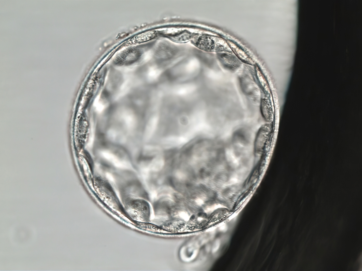 #fertility101
What is embryo grading?
Embryo grading is a way embryologists assess embryos based on factors like appearance, symmetry, cell structure, and development stage. It helps the lab team compare embryos, but it does not predict outcomes on its own.
#ivf #embryo