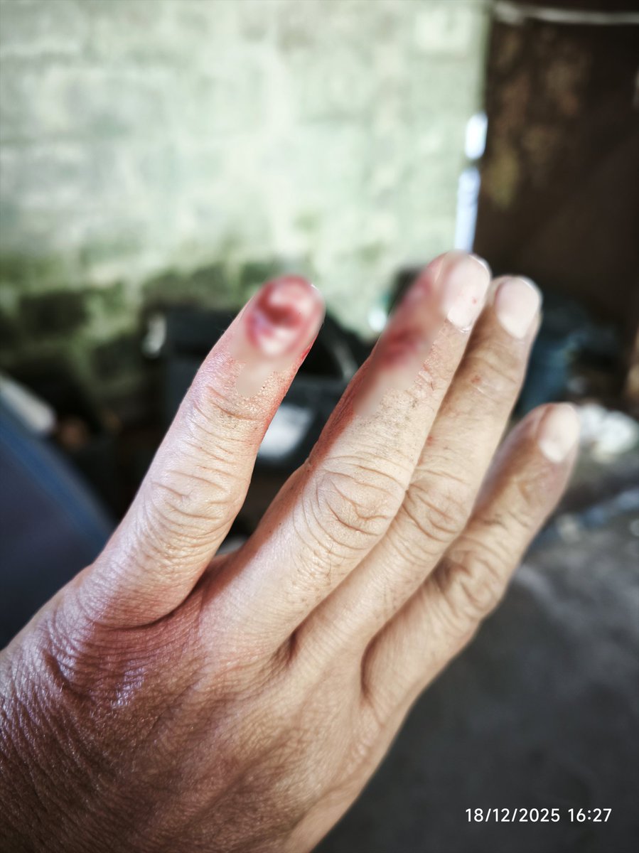 นอนน้อยเป็นเหตุ 🥺